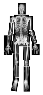 Picture of True to life human x-rays